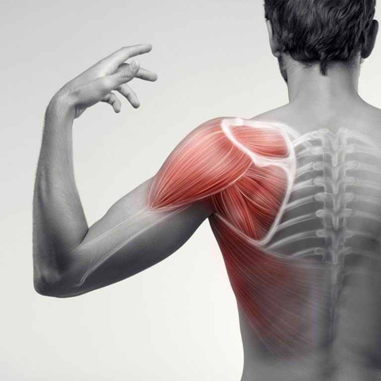 Músculo-esquelético